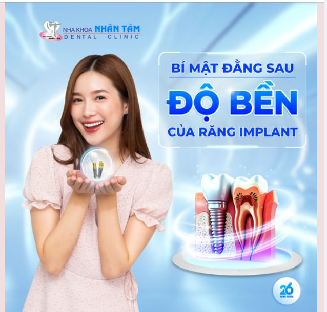 Bí mật đằng sau độ bền của răng Implant