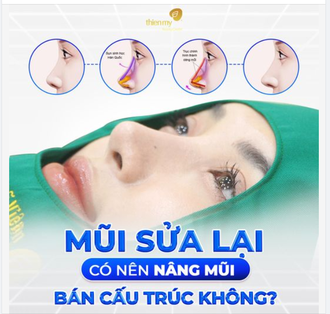 Việc quyết định liệu nên thực hiện nâng mũi bán cấu trúc hay không là một quyết định quan trọng và cần được cân nhắc kỹ lưỡng.