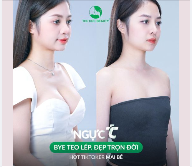 Chỉ 10 suất Ngực TC -35% hôm nay đẹp ngay mừng Đại lễ