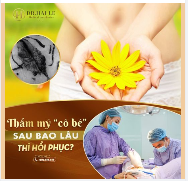 Thẩm mỹ "cô bé" bao lâu thì hồi phục