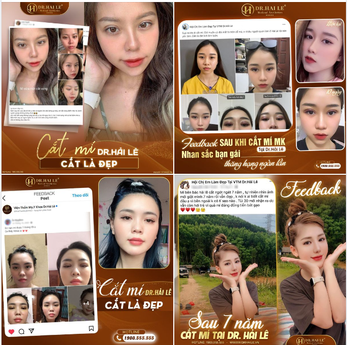 MẮT HAI MÍ - XINH NHƯ Ý 