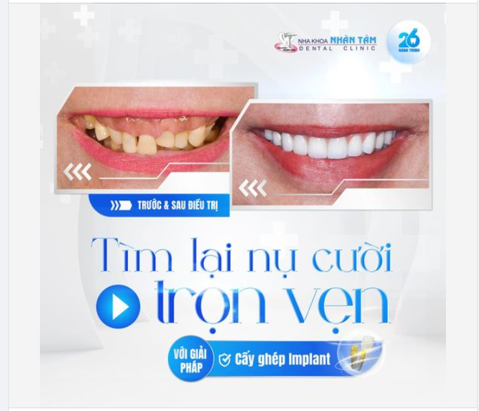Khách hàng 59 tuổi quyết tâm đi tìm nụ cười mới để tự tin hơn