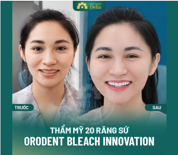 Sở hữu nụ cười răng sứ đẹp rạng ngời sau khi làm thẩm mỹ 20 răng sứ Orodent Innovation tại nha khoa Delia, chị Đặng Thị Ngọc cảm thấy vô cùng hài lòng bởi bản thân trông trẻ trung và tự tin hơn rất nhiều.