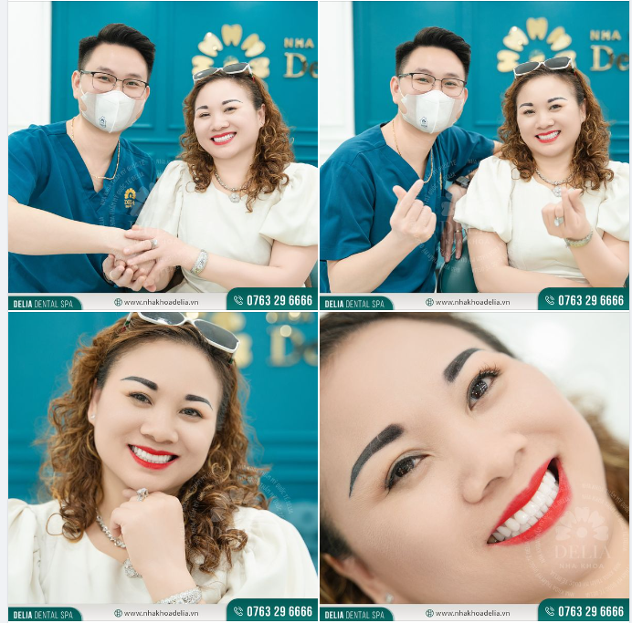 Nụ cười rạng rỡ của chị Lê Thị Bằng trong ngày tái khám bọc răng sứ tại nha khoa Delia.