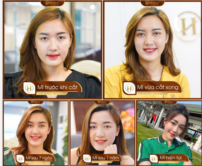 Với vai trò là một “nhân vật của công chúng” Quỳnh Thanh rất chăm chút cho ngoại hình của mình.