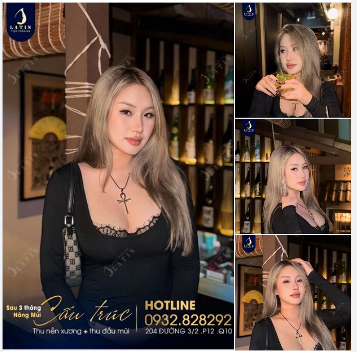 Chụp ảnh xinh cùng dáng mũi xịn. Mũi 3 tháng đẹp xuất sắc cho em gái. Nhan sắc này không phải "dạng vừa đâu" đúng không ạ