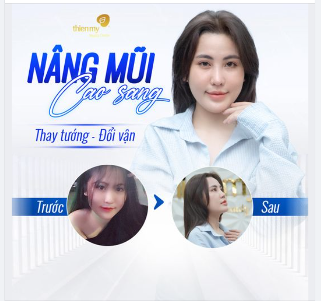 Nâng Mũi Cao Sang - Thay Tướng Đổi Vận