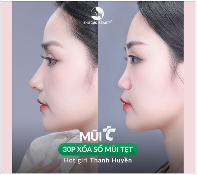 Bệnh viện Thẩm mỹ Thu Cúc  Nơi sắc đẹp khởi nguồn hạnh phúc!