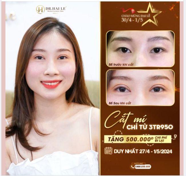 Đại Lễ 30/4 - 1/5 chỉ còn cách chúng ta ít ngày, bạn đã kịp “cắt mí nâng hạng nhan sắc” để đi chữa lành chưa?