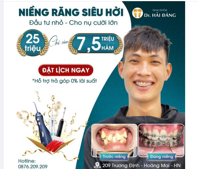 NIỀNG RĂNG THẢ GA KHÔNG LO VỀ GIÁ