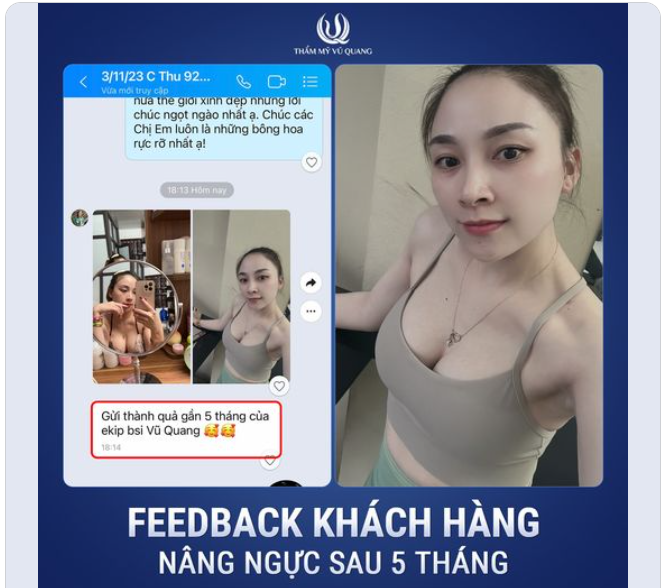 Feedback khách hàng cực mê sau 5 tháng làm ngực tại Thẩm mỹ Vũ Quang