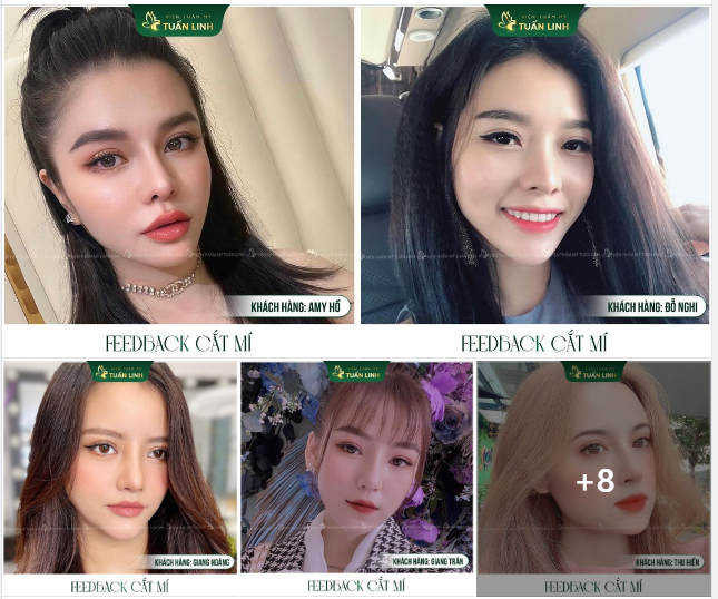FEEDBACK CẮT MÍ Mí xinh đẹp - Hút mọi khách hàng
