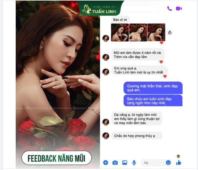 Feedback nâng mũi sau 4 năm - Bền đẹp dài lâu!!