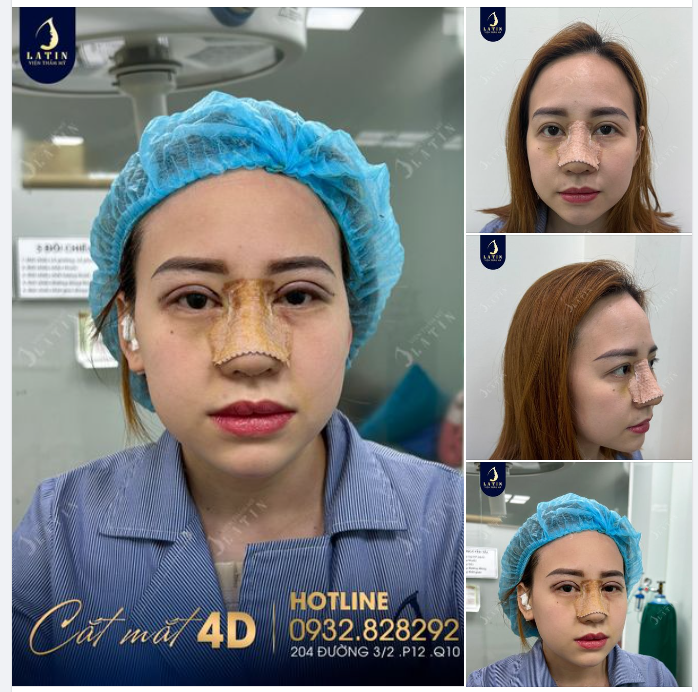 Thay đổi toàn diện từ a-z cho chị gái từ Singapore về Việt Nam làm đẹp