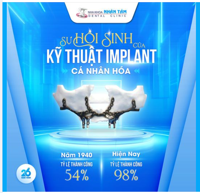 Cấy ghép Implant cá nhân hoá. Tỷ lệ thành công đến 98%. “Cứu cánh” cho trường hợp mất răng khó