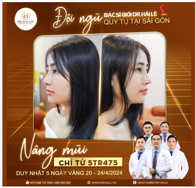 Nâng mũi chỉ từ 5tr475?