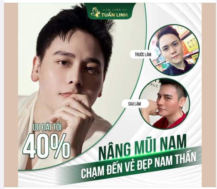 Nâng mũi nam- Chạm đến vẻ đẹp nam thần