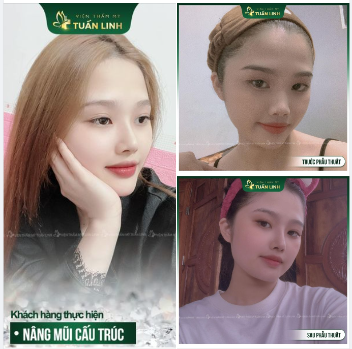 Dáng mũi siêu xinh, hút ngàn may mắn!!