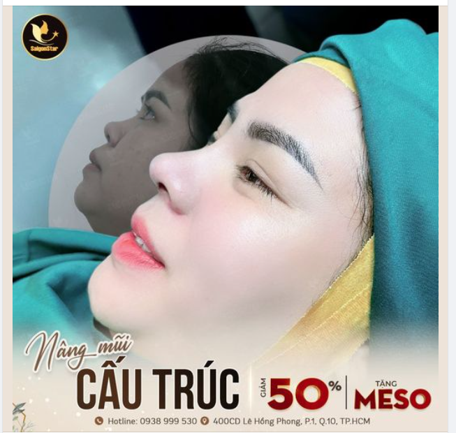 NÂNG MŨI CẤU TRÚC – FORM TỰ NHIÊN ĐẦU MŨI TRÒN ĐẦY