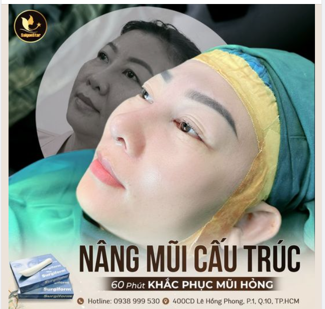 KHẮC PHỤC MŨI HỎNG – TÌM LẠI TỰ TIN