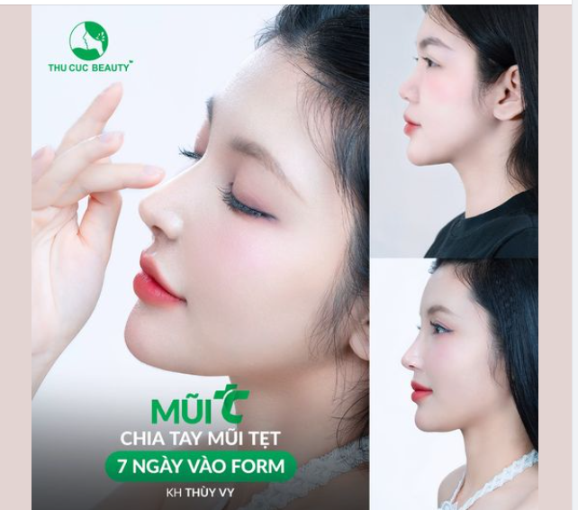 Tạm biệt sống mũi thấp, đầu mũi to chỉ 30P