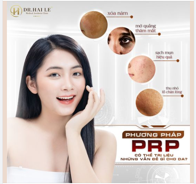 Phương pháp PRP có thể trị liệu những vấn đề nào về da?