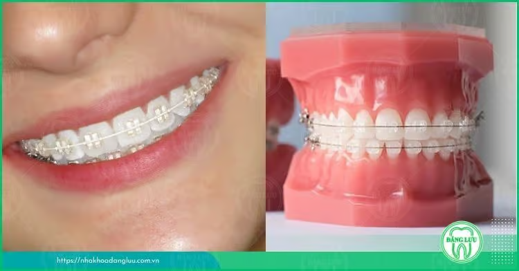 nieng-rang-mac-cai-su