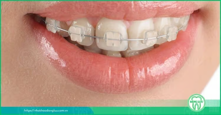 nieng-rang-mac-cai-su