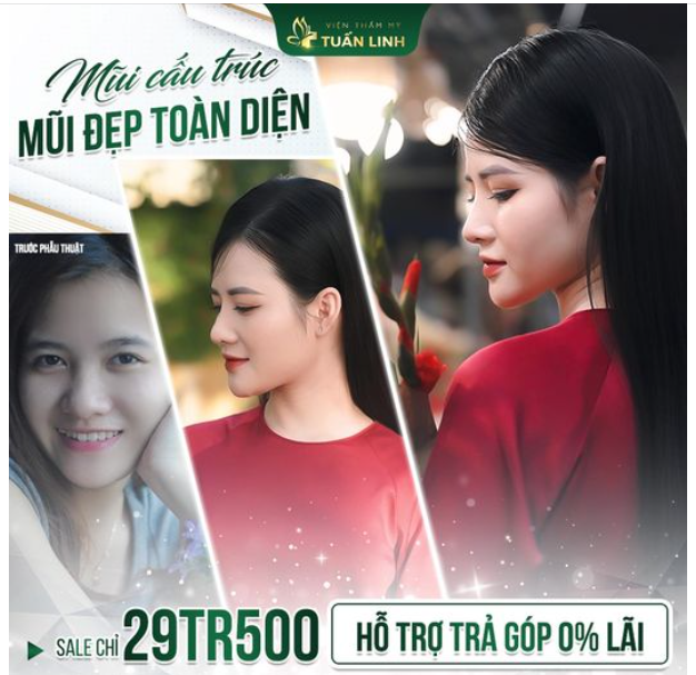 NỔ INBOX ẦM ẦM VÌ MŨI CẤU TRÚC CHỈ  29TR500