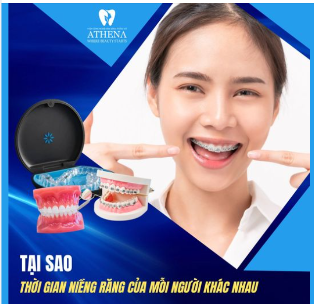 Vì sao cùng “niềng răng” mà kết quả và thời gian niềng khác nhau?