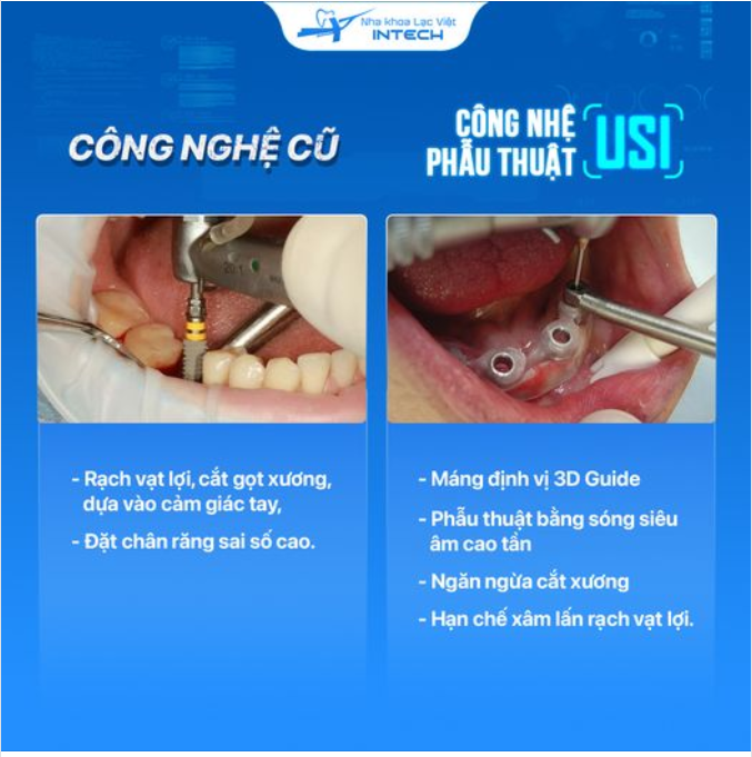 KHÁC BIỆT LỚN NHẤT CÔNG NGHỆ CŨ VÀ CÔNG NGHỆ PHẪU THUẬT USI