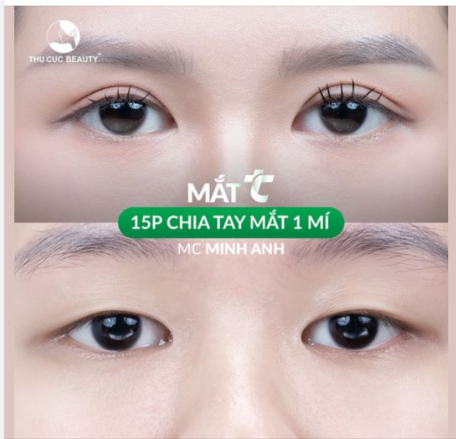 15 phút chia tay mắt 1 mí