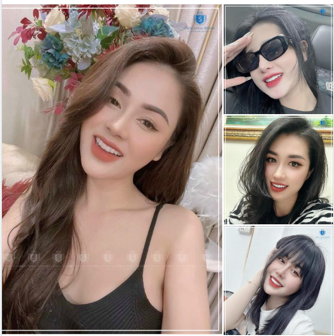 THẨM MỸ RĂNG SỨ - CHÂN ÁI CỦA PHÁI ĐẸP