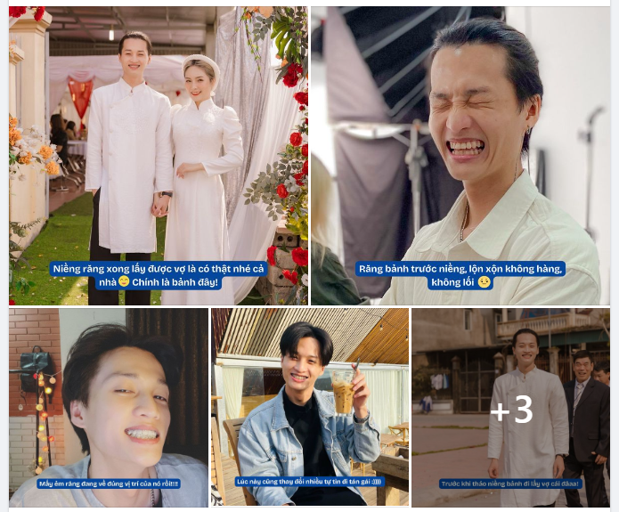 "Cảm ơn niềng răng đã cho mình người bạn đồng hành xinh đẹp và công việc thuận lợi !!!