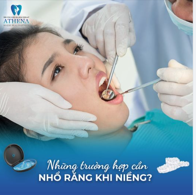 NHỮNG TRƯỜNG HỢP CẦN NHỔ RĂNG KHI NIỀNG?