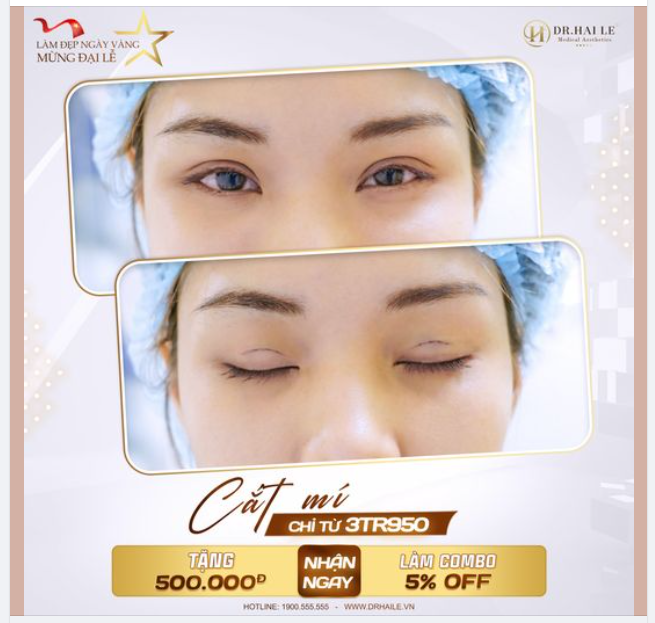 Đại Lễ này, bạn nhất định phải đến Dr.Hải Lê cắt mí để chia tay cặp mí khuyết điểm, rinh cho mình đôi mắt hoàn hảo và loạt ưu đãi chưa từng có nhaaaa
