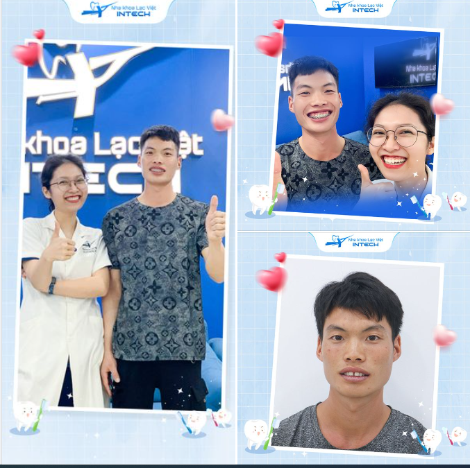 VƯỢT HƠN 400KM ĐỂ NIỀNG RĂNG, CHÀNG THANH NIÊN NGƯỜI DAO NGÀY CÀNG ĐIỂN TRAI