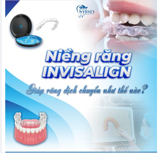 NIỀNG INVISALIGN GIÚP RĂNG DỊCH CHUYỂN NHƯ THẾ NÀO?
