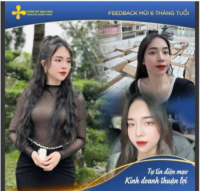 Hành trình độ lại “chiếc mũi xinh” của Boss Magic Skin Nguyễn Thanh Ngọc