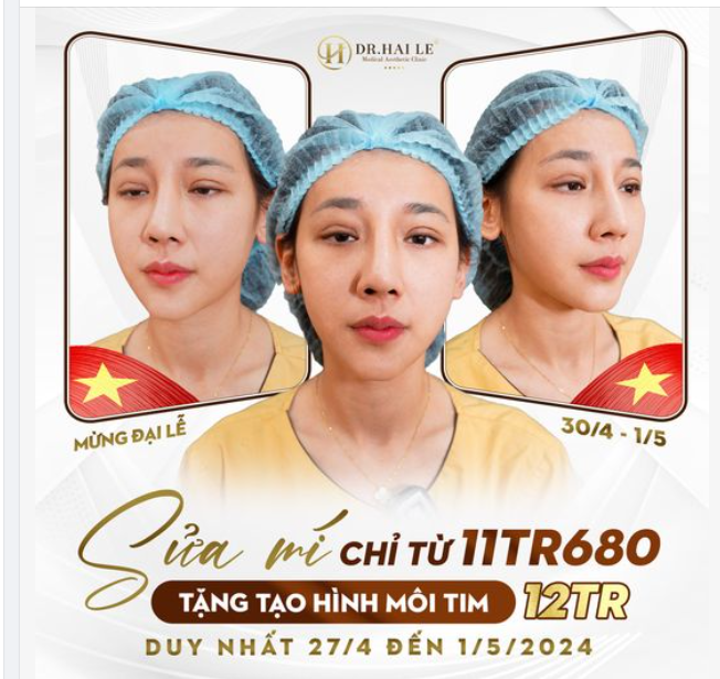 5 ngày vàng làm đẹp đón Đại Lễ, Dr.Hải Lê tặng chị em sửa mí ưu đãi cực mê nha. Đừng bỏ qua, tiếc lắm đó!!!