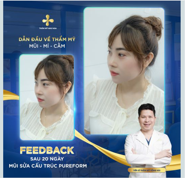 MŨI XINH 20 NGÀY TUỔI gọi tên CẤU TRÚC PUREFORM