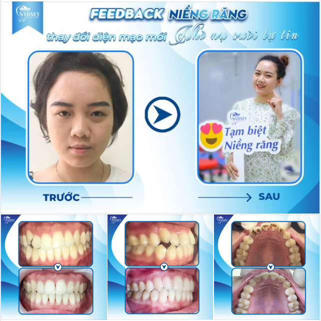 THAY ĐỔI DIỆN MẠO MỚI NHỜ NỤ CƯỜI TỰ TIN