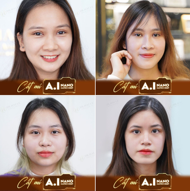 Dr.Hải Lê đã làm đẹp lại còn ra mắt thêm công nghệ mới giúp khách hàng tăng rất nhiều trải nghiệm khi làm đẹp thì sẽ như thế nào ?
