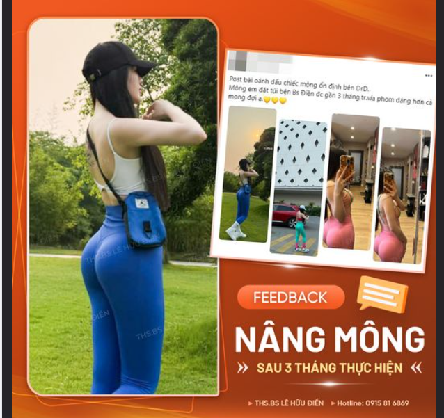 FEEDBACK ĐỘN MÔNG SAU 3 THÁNG THỰC HIỆN