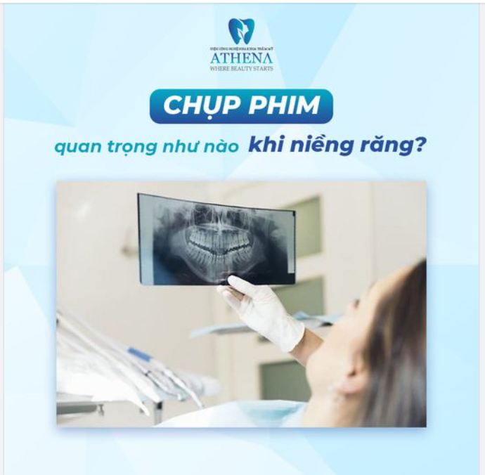 CHỤP PHIM QUAN TRỌNG NHƯ NÀO KHI NIỀNG RĂNG?