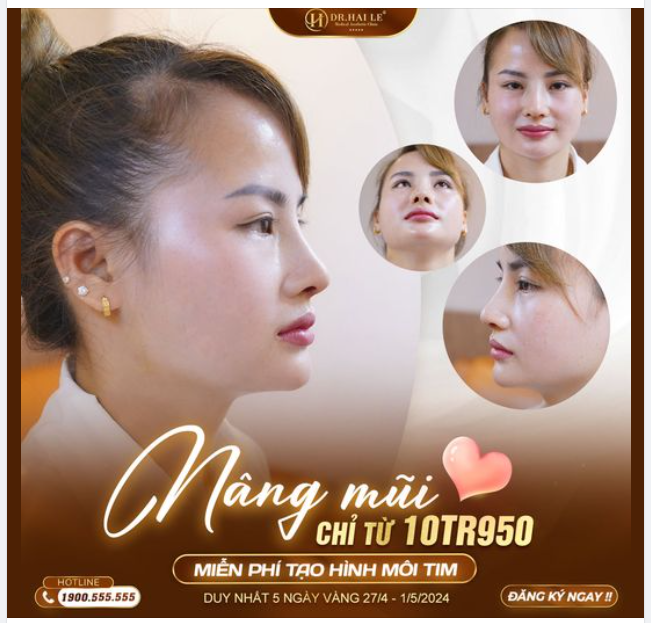 Nâng mũi tại Dr.Hải Lê chưa bao giờ nhiều ưu đãi KHỦNG đến vậy.