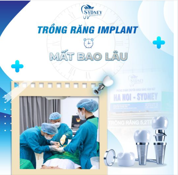 TRỒNG RĂNG IMPLANT MẤT BAO LÂU?