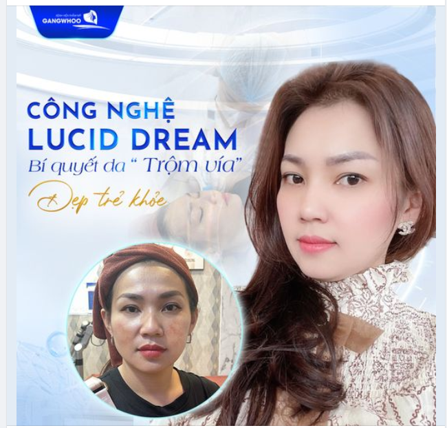 CÔNG NGHỆ LUCID DREAM Bí quyết da trộm vía trẻ, khỏe, đẹp