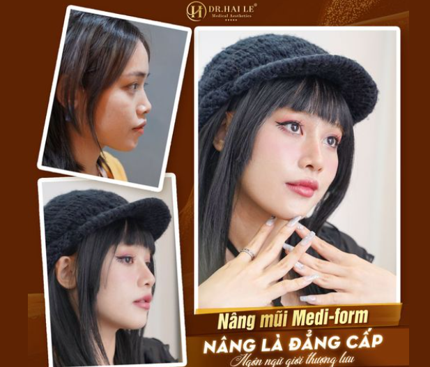 Chiếc mũi cao bay, đẹp sang không sến không chỉ giúp bạn thăng hạng nhan sắc mà còn là minh chứng cho đẳng cấp của bạn.