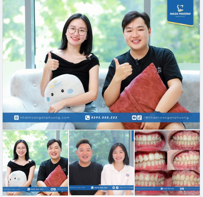 Bộ 3 cùng tiến nay răng ai cũng đều đẹp